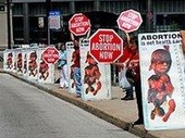 В США клиника отказалась от поздних абортов