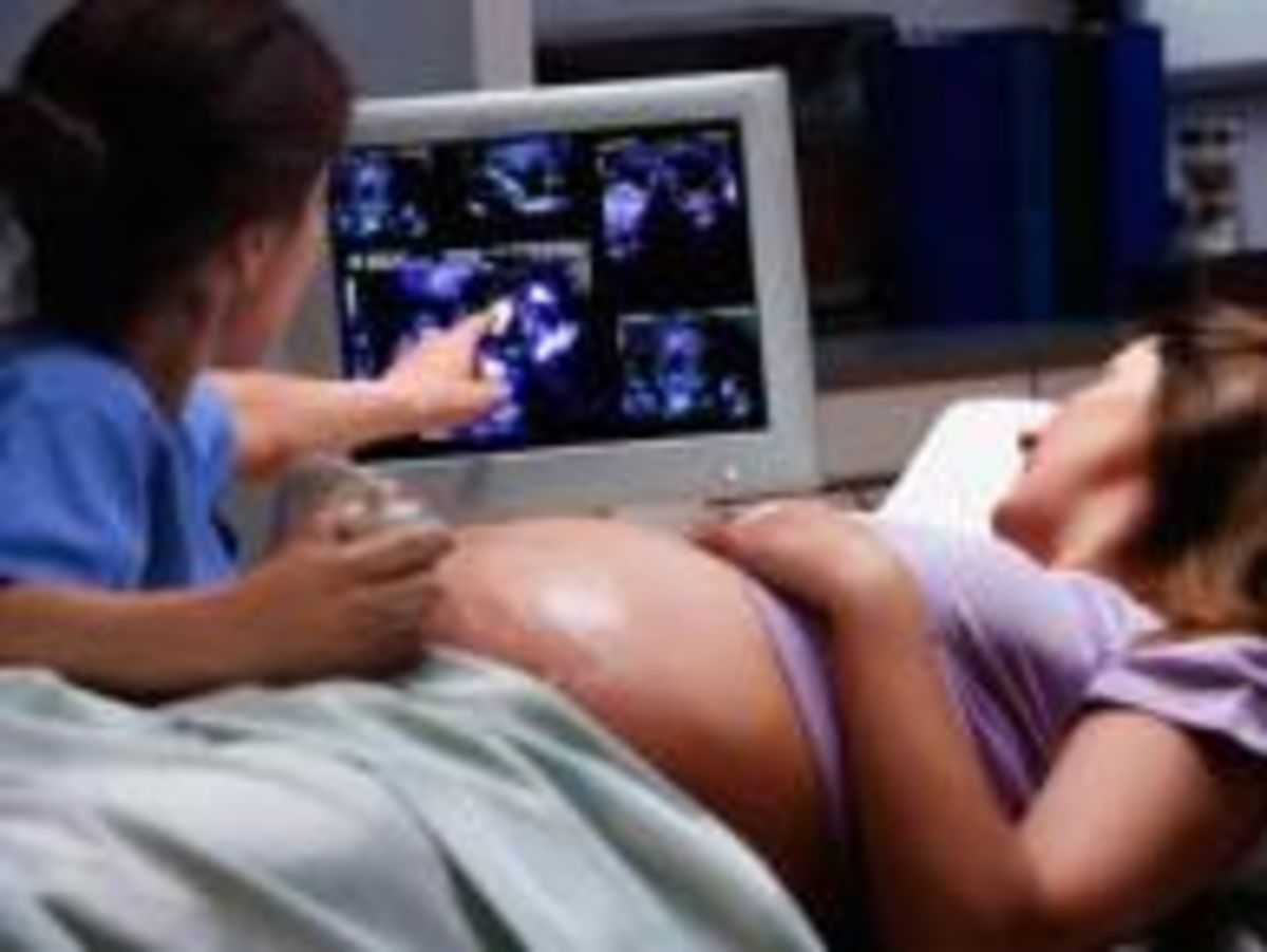 «Они пытаются убедить людей, что зародыш на ранней стадии беременности – это не ребенок, а сгусток клеток…»